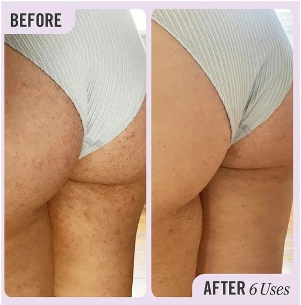 Скраб для тіла First Aid Beauty KP Bump Eraser Body Scrub with 10% AHA 28.3g 2798468220 фото