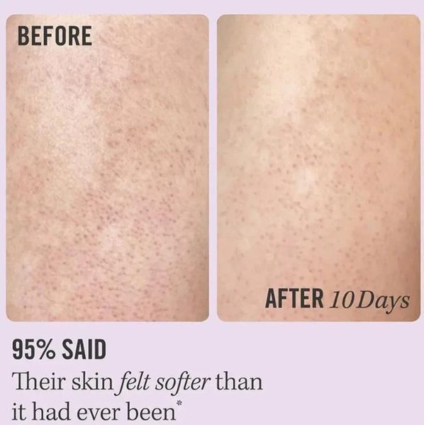 Скраб для тіла First Aid Beauty KP Bump Eraser Body Scrub with 10% AHA 28.3g 2798468220 фото