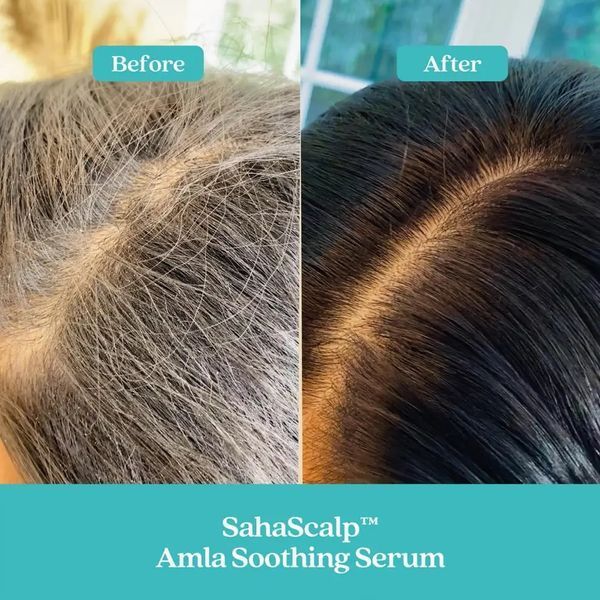 Fable & Mane SahaScalp Amla Soothing Serum 14.4ml Олія-сироватка для шкіри голови 3046921165 фото