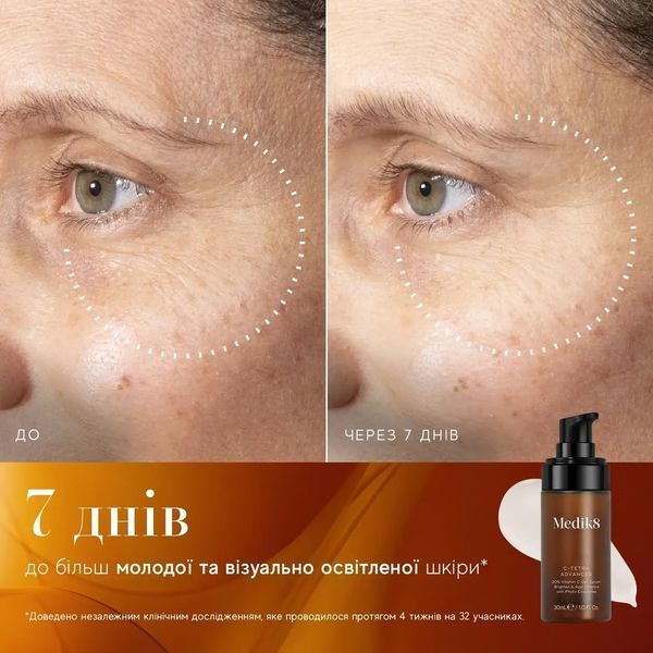 Medik8 C-Tetra Advanced 20% Vitamin C Gel-Serum 30ml Сыворотка для лица 2954589928 фото