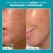 Paula's Choice Skin Perfecting 2% BHA Liquid Exfoliant 10ml Ніжний відлущувальний тонік ексфоліант 690781 фото 6
