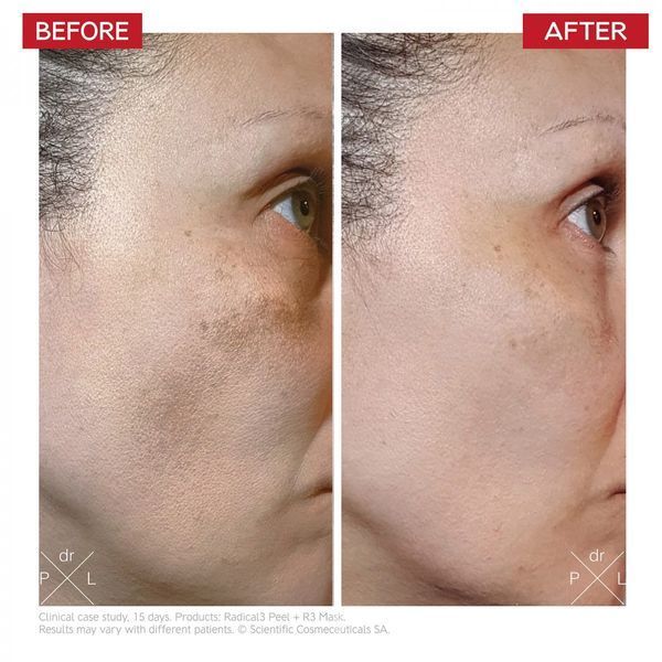 Пілінг для обличчя Dr. Levy Switzerland Radical3 Reboot Pro Peel 50ml 2731354755 фото