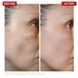 Пілінг для обличчя Dr. Levy Switzerland Radical3 Reboot Pro Peel 50ml 2731354755 фото 5