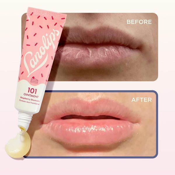 Бальзам для губ Lanolips Raspberry Shortcake Lip Treatment 10g 2952664872 фото